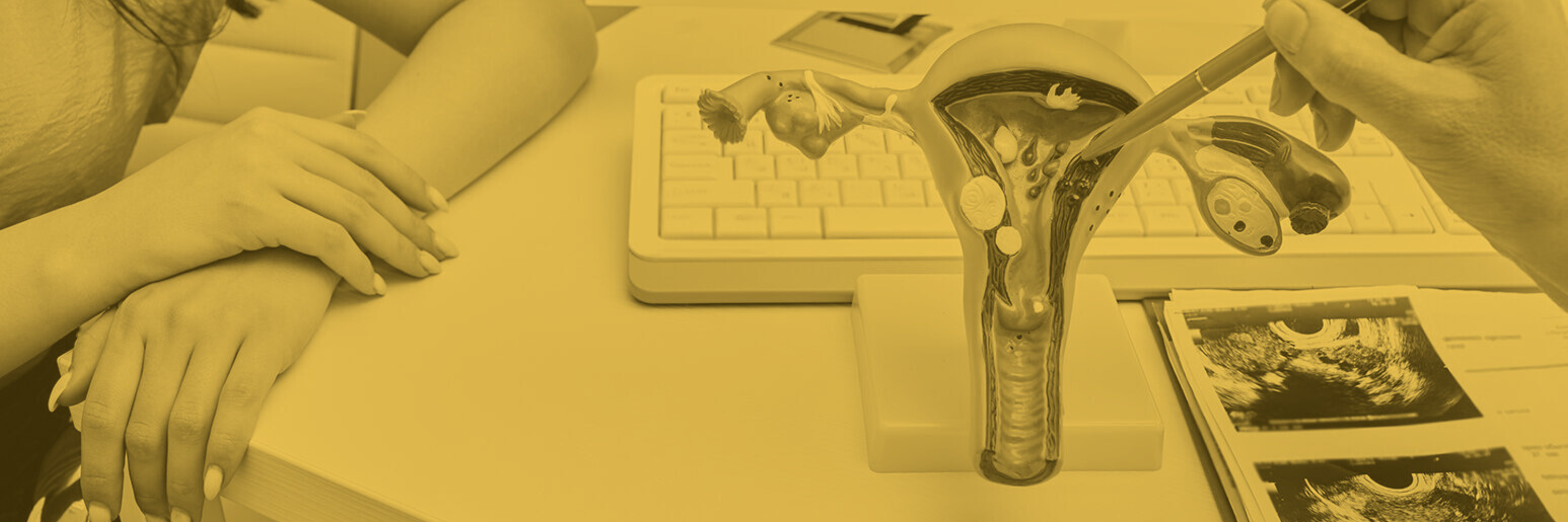 3D printed model of a uterus