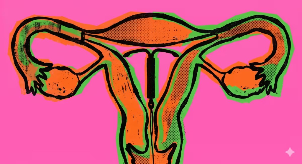 Pop-art style illustration of a uterus with a T-shaped hormonal IUD in place, orange and lime green halftone fill on a hot pink background.
